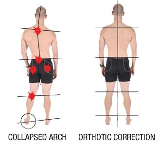 沒有穩固的臀肌、核心肌群與四肢都可能導致骨盆不穩定進而影響膝蓋
