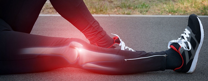 跑者的運動傷害集中在腳部居多。