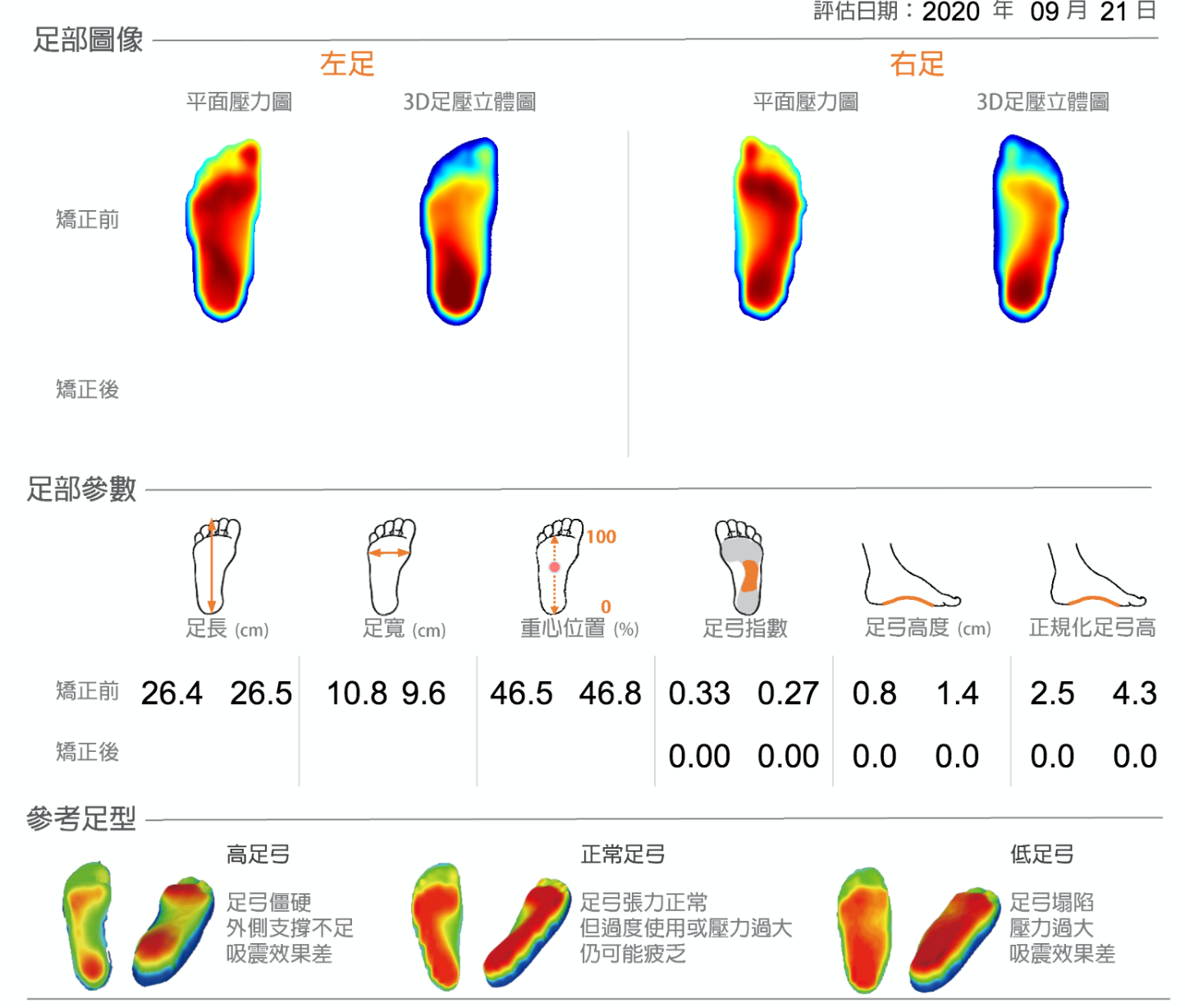 筆者的足底評估報告（圖片來源：黃書韋）