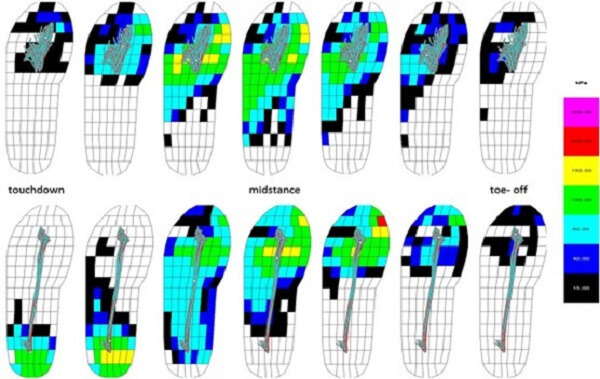 行進間足底壓力移動分佈圖