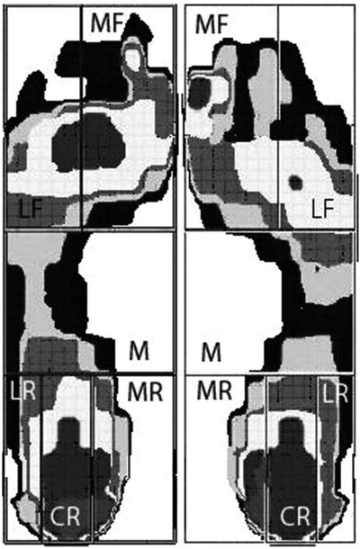 足底壓力區域劃分圖 圖片來源：Journal of Sports Sciences, 30(14), 1545-1550.