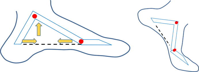 絞盤機制(windlass mechanism)，墊腳時足底筋膜向內收縮，足弓向上拱起