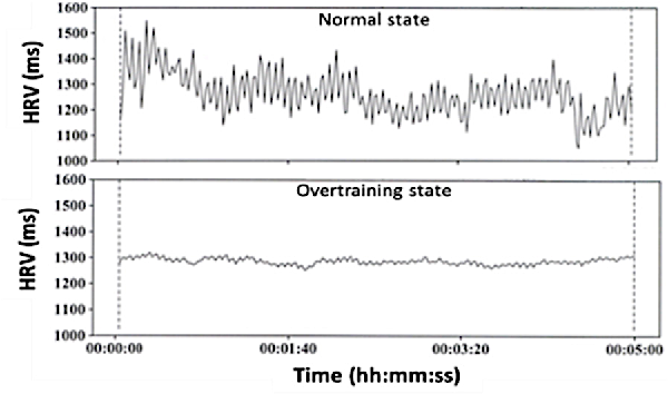 Stress and Recovery Analysis Method Based on 24-hour Heart Rate Variability. Published 2014 Firstbeat technology